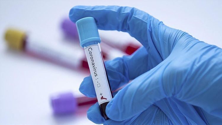 Israel's health minister tests positive for coronavirus