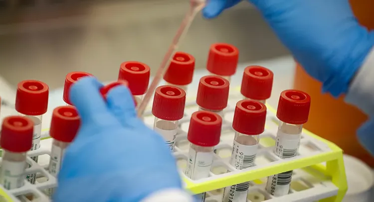 Russia confirms 658 new coronavirus cases in 24 hours