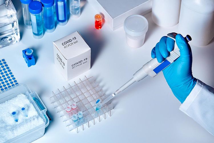 44,753 people tested for coronavirus in Azerbaijan so far
