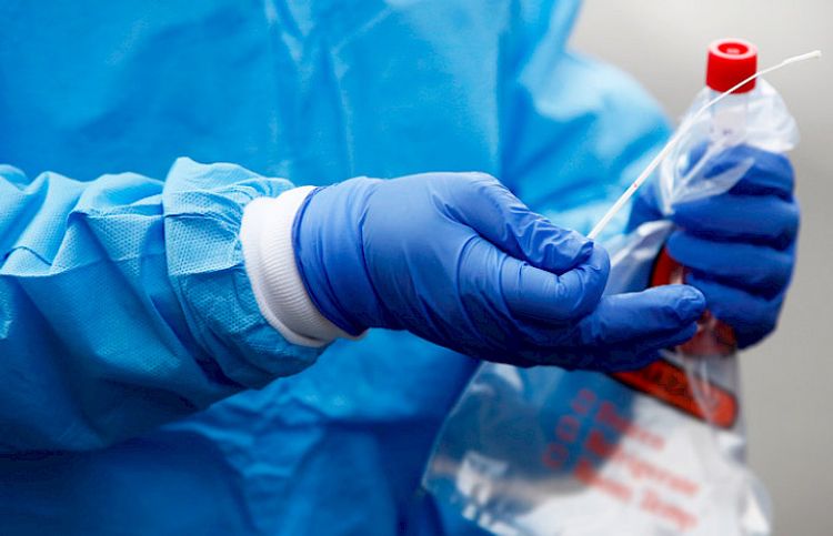 Uzbekistan's coronavirus cases reaches 390