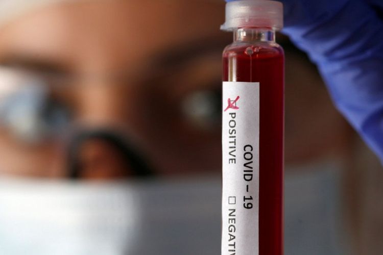 More than 45 thousand people tested for coronavirus in Azerbaijan, 4369 quarantined