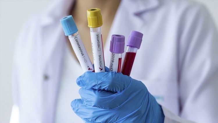 Global coronavirus infections top 1.3M