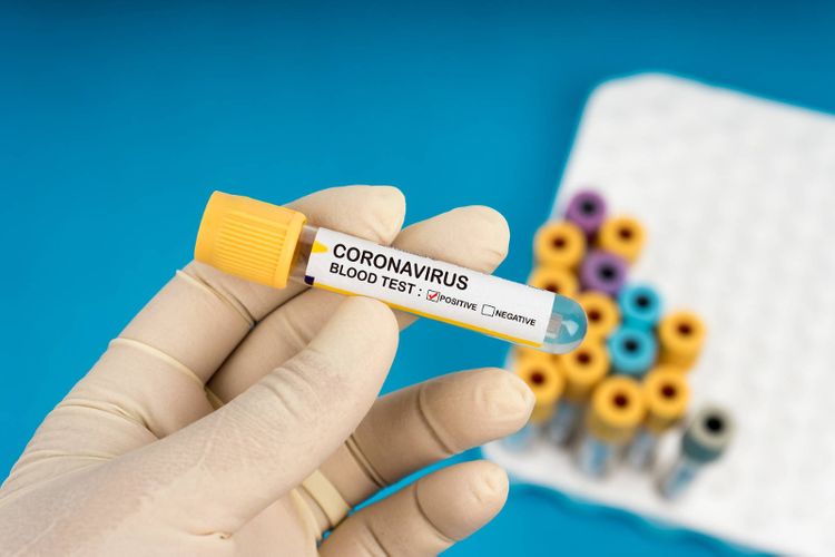 32 new coronavirus cases detected in Kazakhstan, total at 759 