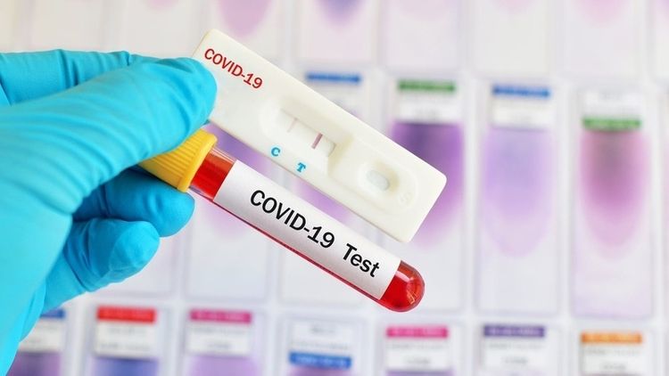 Total of COVID-19 cases in Uzbekistan hikes to 555