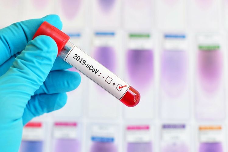 Russia to send more coronavirus test kits to CIS countries