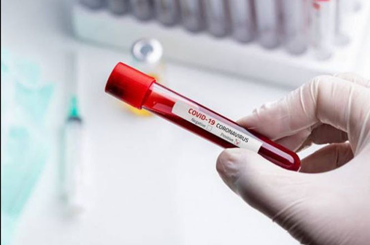  Coronavirus cases in Armenia grow to 977, death toll rises to 13 - UPDATED