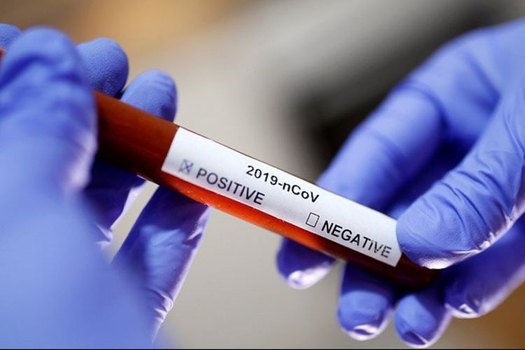 Some Azerbaijani citizens in Russia test positive for coronavirus