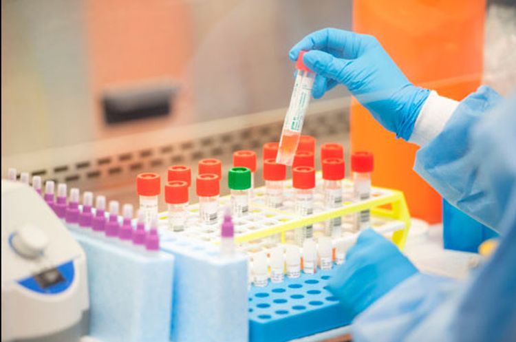 16 people tested positive for COVID-19 in occupied territories of Azerbaijan 