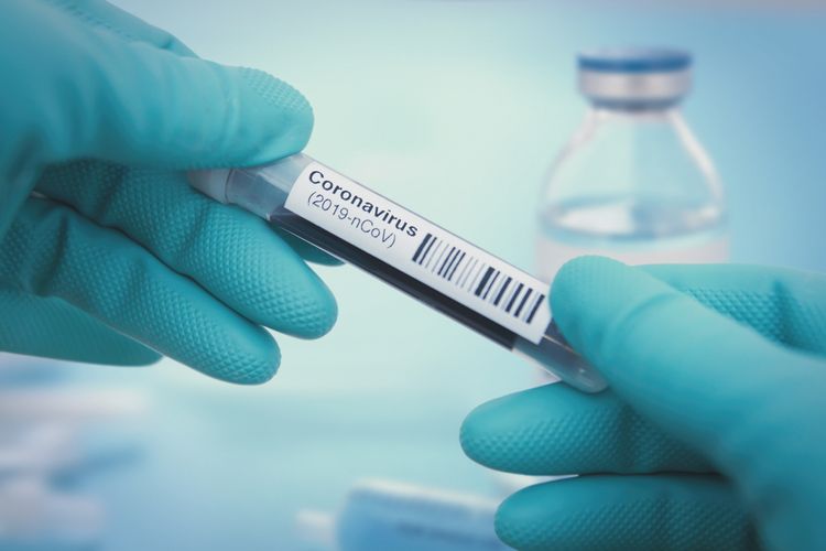 Czech Republic reports no deaths from COVID-19 first time since March 23