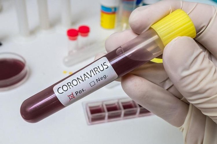 Kazakhstan records almost 70 new COVID-19 cases 