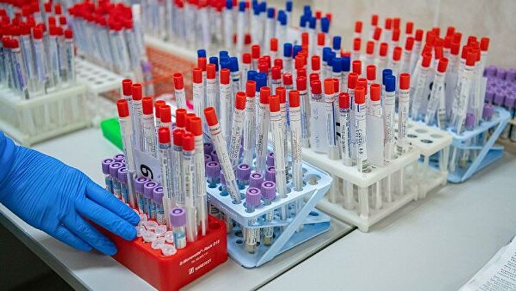 Number of people infected with coronavirus  increased to 1380 people in Uzbekistan