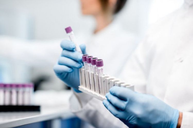 Coronavirus cases in Armenia grow by 42 in a day, number of deaths increases to 19