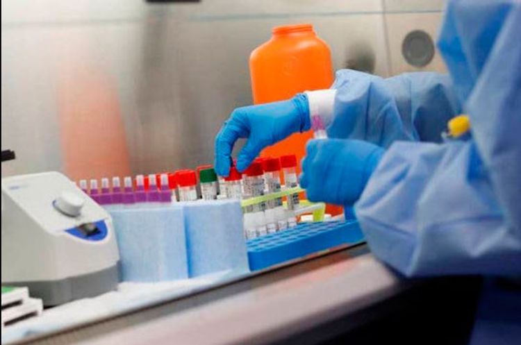 Coronavirus cases in Armenia reach 1339, number of deaths increases to 22
