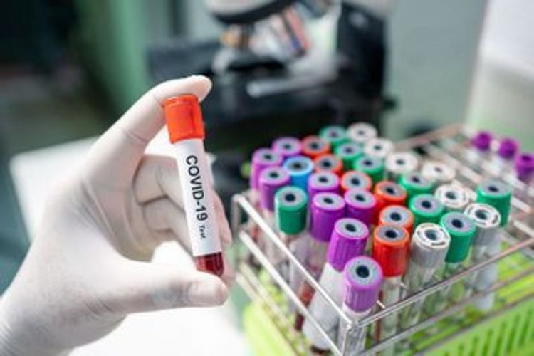 Number of confirmed coronavirus cases in Azerbaijan reach 1436, with 791 recoveries and 19 deaths