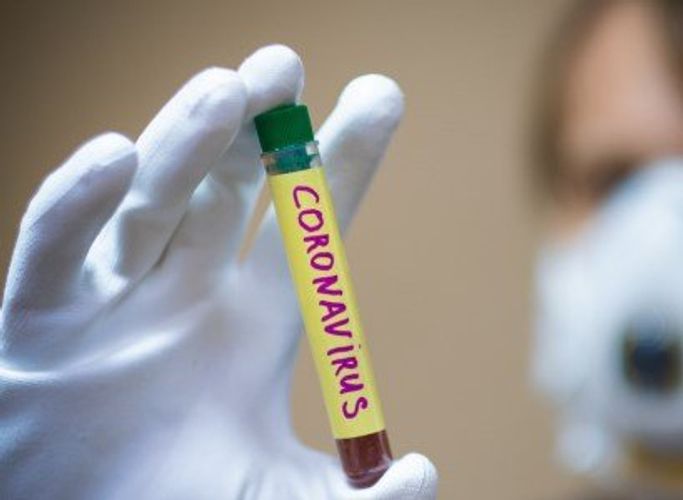 Armenia prosecutor tests positive for COVID-19