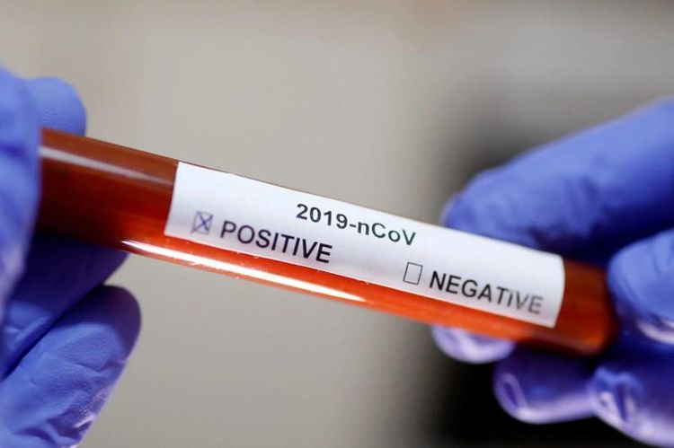 Kazakhstan reports 2416 confirmed coronavirus cases 