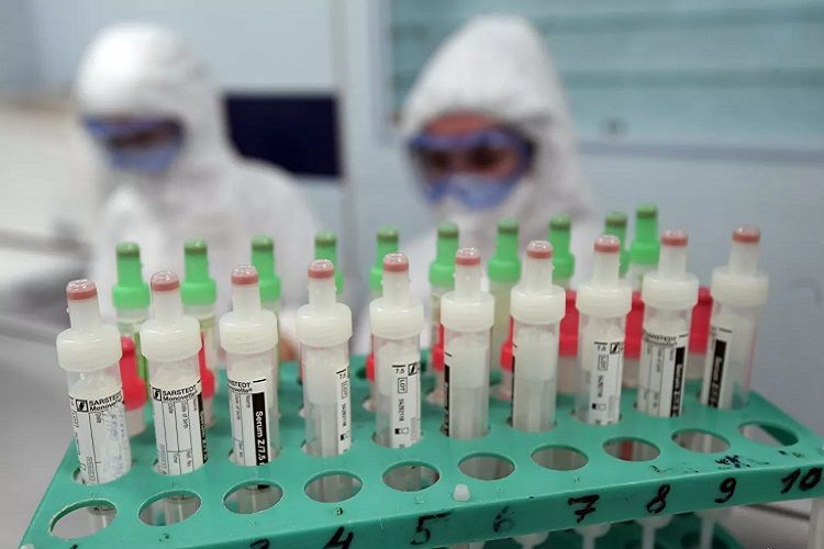 Number of COVID-19 cases in Azerbaijan reach 1645, with 1139 recoveries and 21 deaths