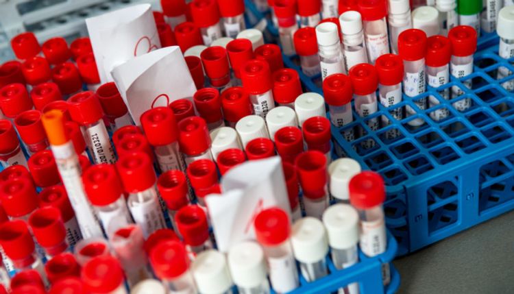 Ukraine confirms 9,410 coronavirus cases