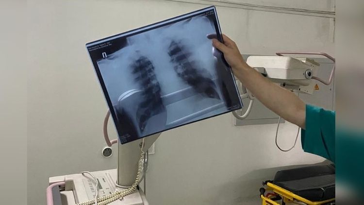 Kazakhstan reports 1,226 coronavirus and 5,181 pneumonia cases