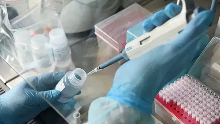 Number of confirmed coronavirus cases reaches 33,647 in Azerbaijan, 492 deaths