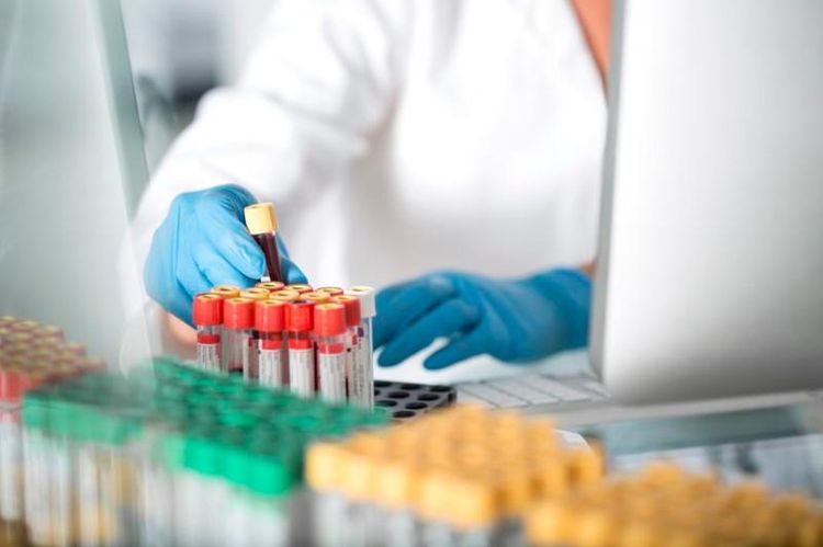 Number of COVID-2019 cases across globe up by over 628,000 in past day