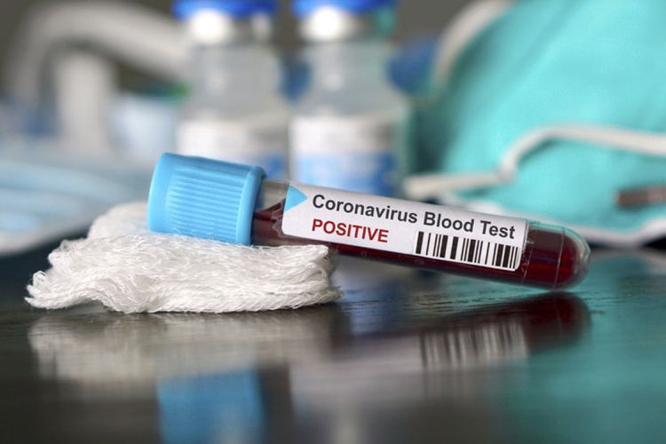 Number of confirmed coronavirus cases reaches 211,764 in Azerbaijan, 2,416 deaths cases