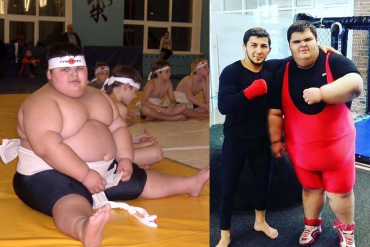 Russian dubbed ‘world’s heaviest boy’ by Guinness dies aged 21 - PHOTO