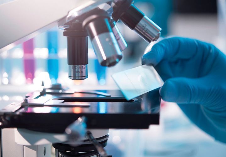 Diagnostic tools set of coronavirus brought to Azerbaijan 