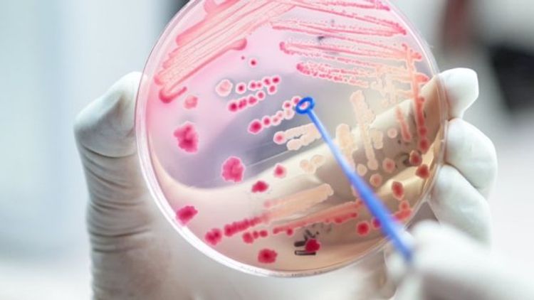 'Alarming' one in five deaths due to sepsis