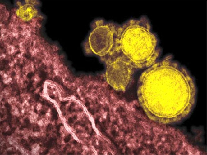 UAE confirms new coronavirus case in family arriving from China