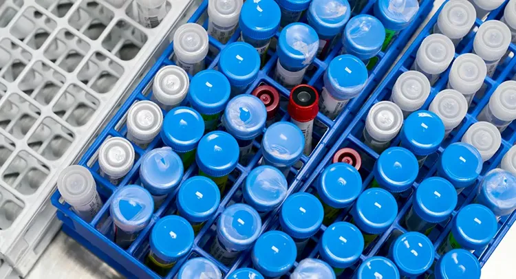 New coronavirus form more contagious, similar in severity, study shows