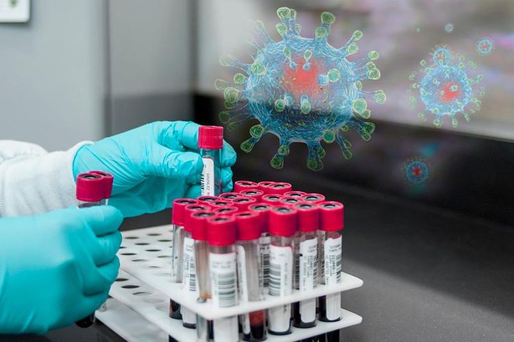 1,501 coronavirus cases detected in Kazakhstan over 24 hours  