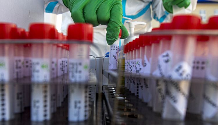 Ukraine records 543 new COVID-19 cases over past 24 hours