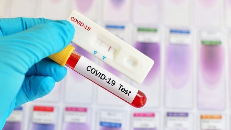 Kyrgyzstan reports 361 new cases of coronavirus, 8,847 in total