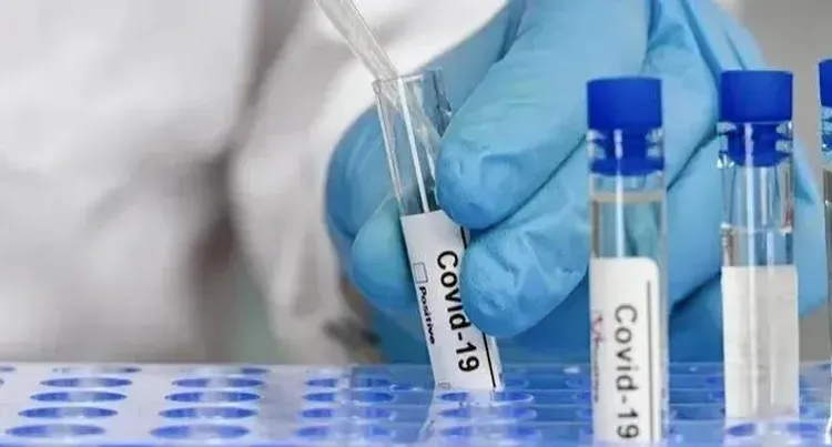 28 military personnel of Georgian Defence Forces test positive for coronavirus 