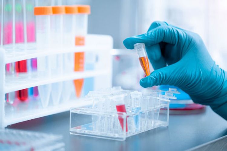 584466 coronavirus tests conducted in Azerbaijan so far