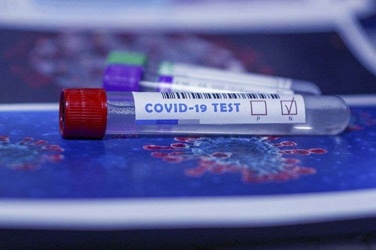  Azerbaijan documents 559 fresh coronavirus cases, 545 recoveries, 7 deaths