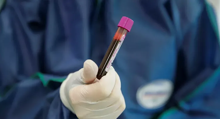 Serbia’s coronavirus cases reach 19,334