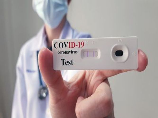 Armenia reports 469 fresh COVID-19 cases, 10 deaths in 24 hours