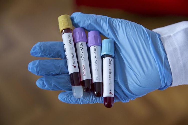 Kazakhstan reports 450 coronavirus-infected patients over past day 