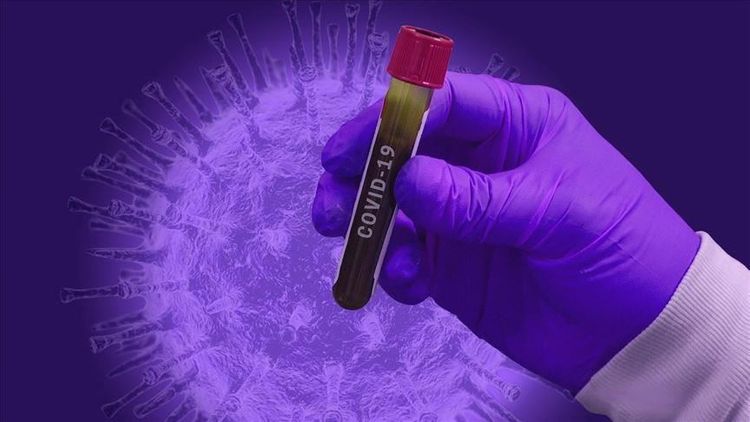 Armenia reports 517 new coronavirus cases, 19 deaths in a day
