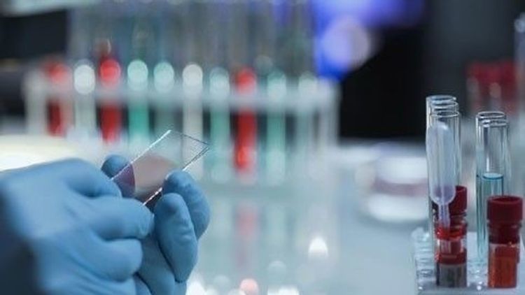 Kyrgyzstan reports 28 new cases of coronavirus, 1,899 in total