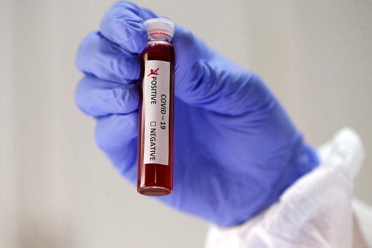 Number of coronavirus-related cases in Kazakhstan surpasses 12,000  
