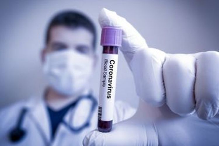 Brazil’s COVID19 death toll surpasses 37,000; over 685,000 cases confirmed