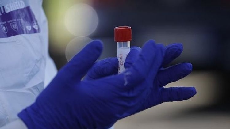 Kazakhstan reports 383 new COVID-19 cases, 15,192 in total