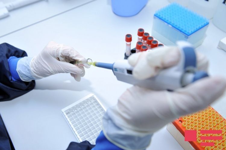 47 people died from viral hepatitis in Azerbaijan last year