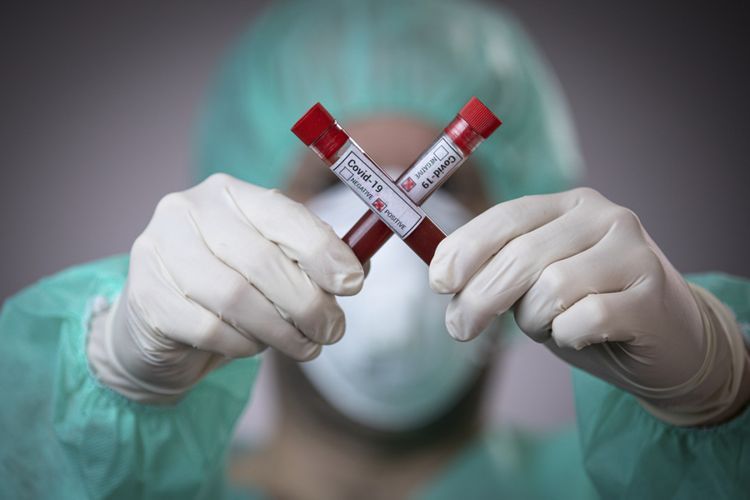 Number of confirmed coronavirus cases in Azerbaijan reach 10 662, with 5948 recoveries and 126 deaths