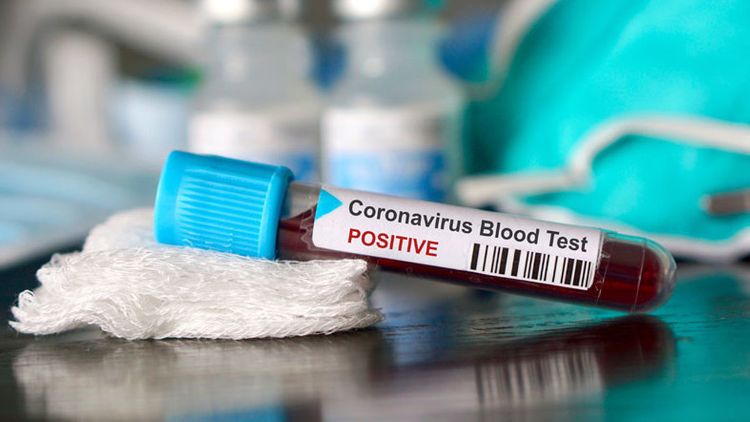 Kyrgyzstan announces 95 new cases of coronavirus, 2,657 in total
