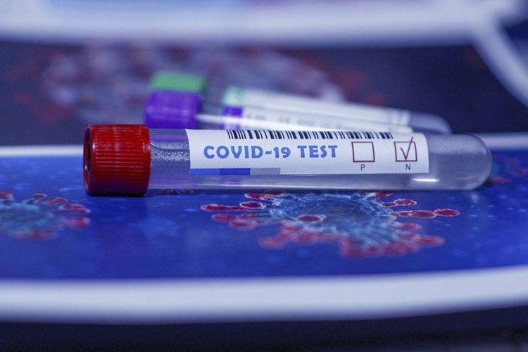 Prime cost of coronavirus test revealed