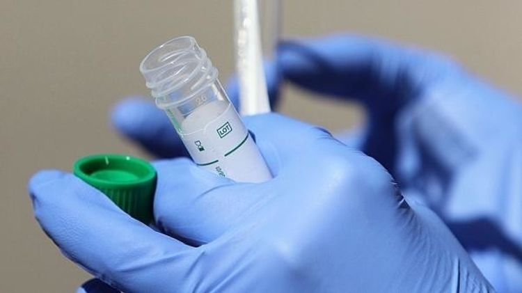 Uzbekistan reports 26 new COVID-19 cases, 5,946 in total